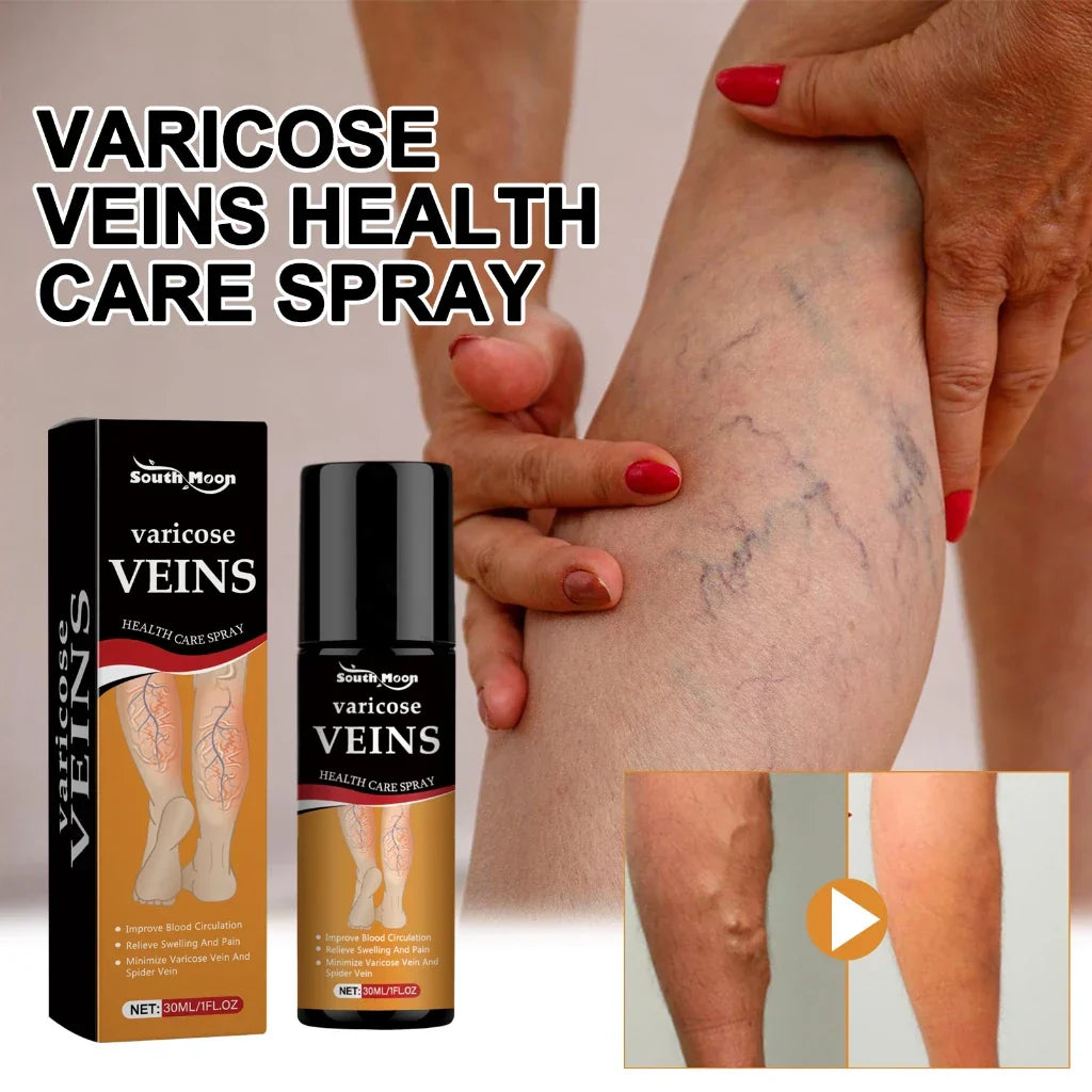 Turmeric Varicose Vein Relief Spray( BUY 1 GET 2 FREE💥 🎁  )
