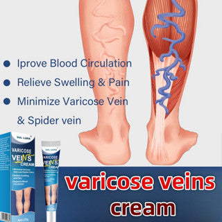 Sol Lora Varicose veins Cream (BUY 1 GET 1 FREE)