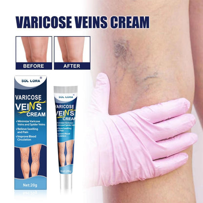 Sol Lora Varicose veins Cream (BUY 1 GET 1 FREE)