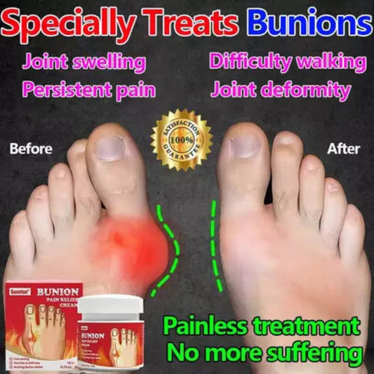 Bunion Joint pain relief cream(BUY 1 GET 1 FREE)