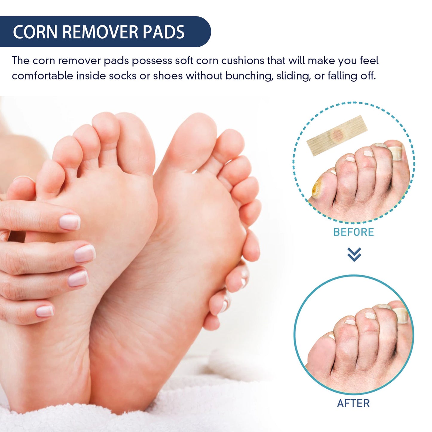 Corn Remover Pads Pack of 24